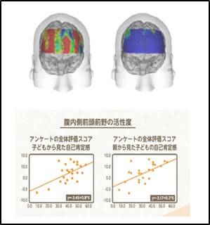 前頭前野の活性度