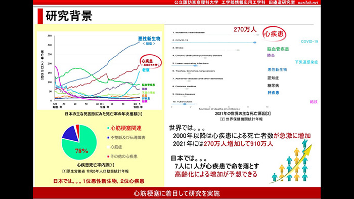 医学ｘ工学＝ＡＩ動画像処理による新しい医療のカタチ！心臓の微細な動き解析によるＡＩ心筋梗塞予測